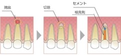 抜歯相談